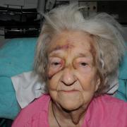 Eileen Blane after the attack